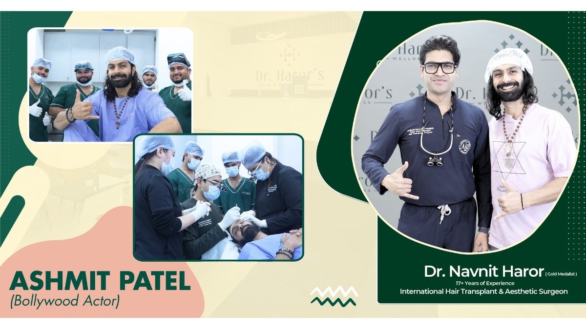 Celebrity Hair Transplant: You’d Never Guess They Had a Hair Transplant—But They Did!-PNN